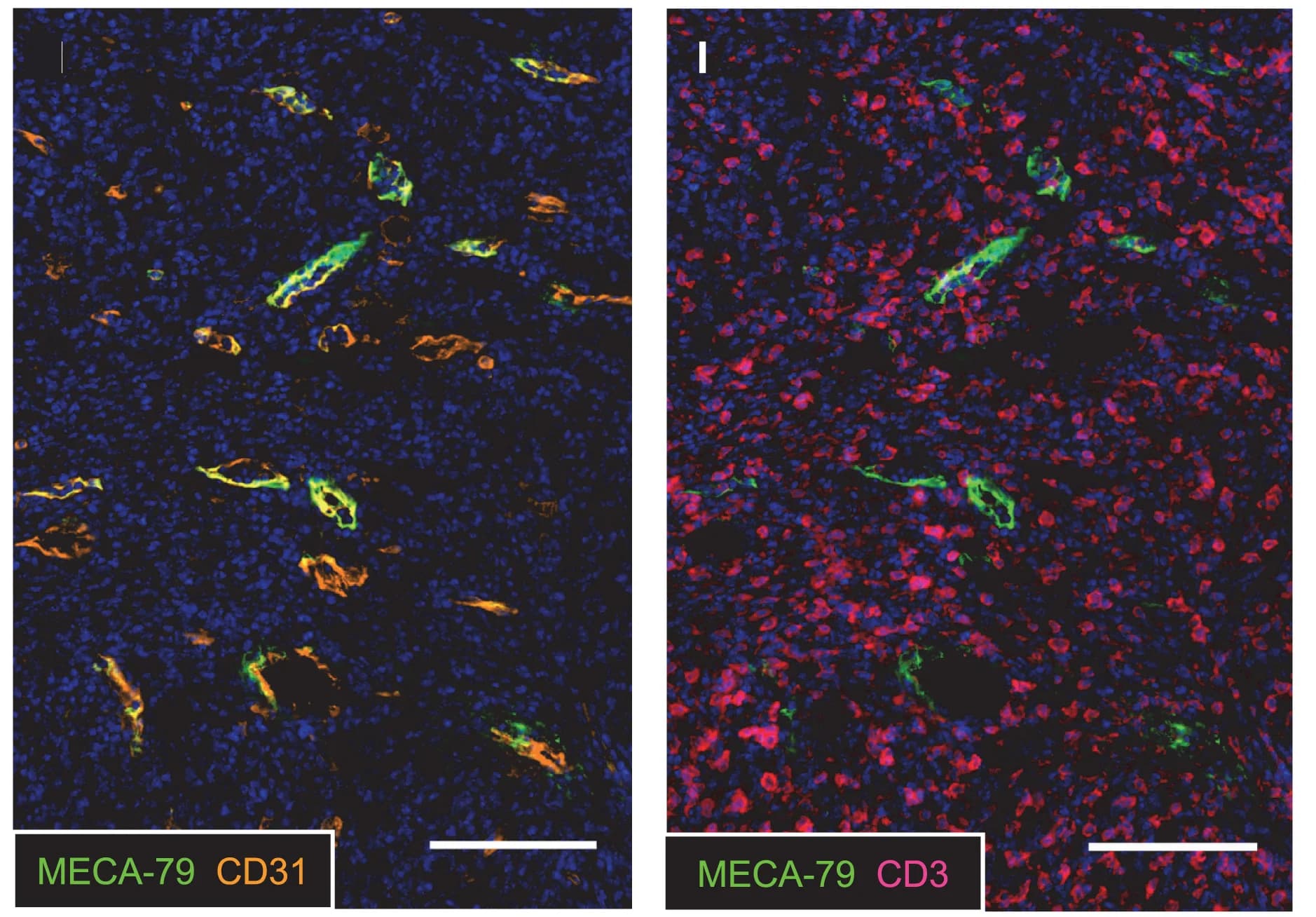 Open access visualization of Microscopy, Immunofluorescence, Anti-CTLA-4 Antibody, Tumor