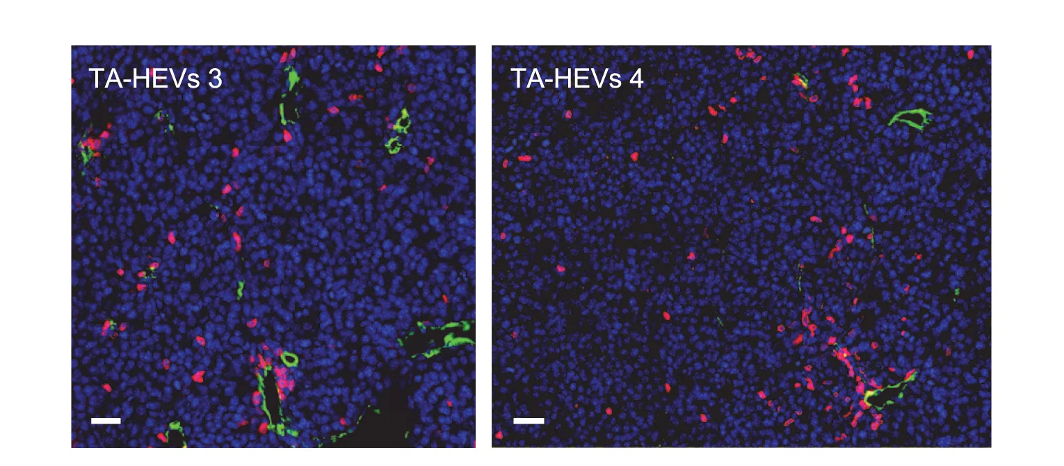 Open access visualization of Microscopy, Immunofluorescence, B16F10 Tumor, Ipilimumab-GAALIE, Anti-PD-1 Antibodies