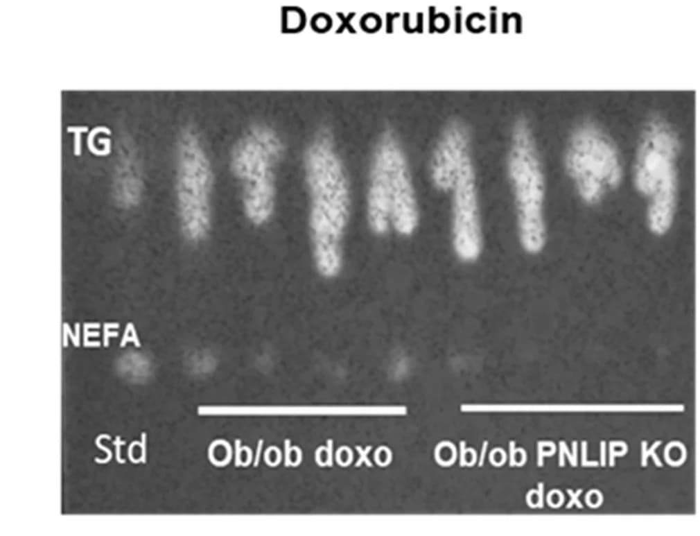 Open access visualization of Gel, Thin-Layer Chromatography, NEFAs, Triglyceride, Fat Pads