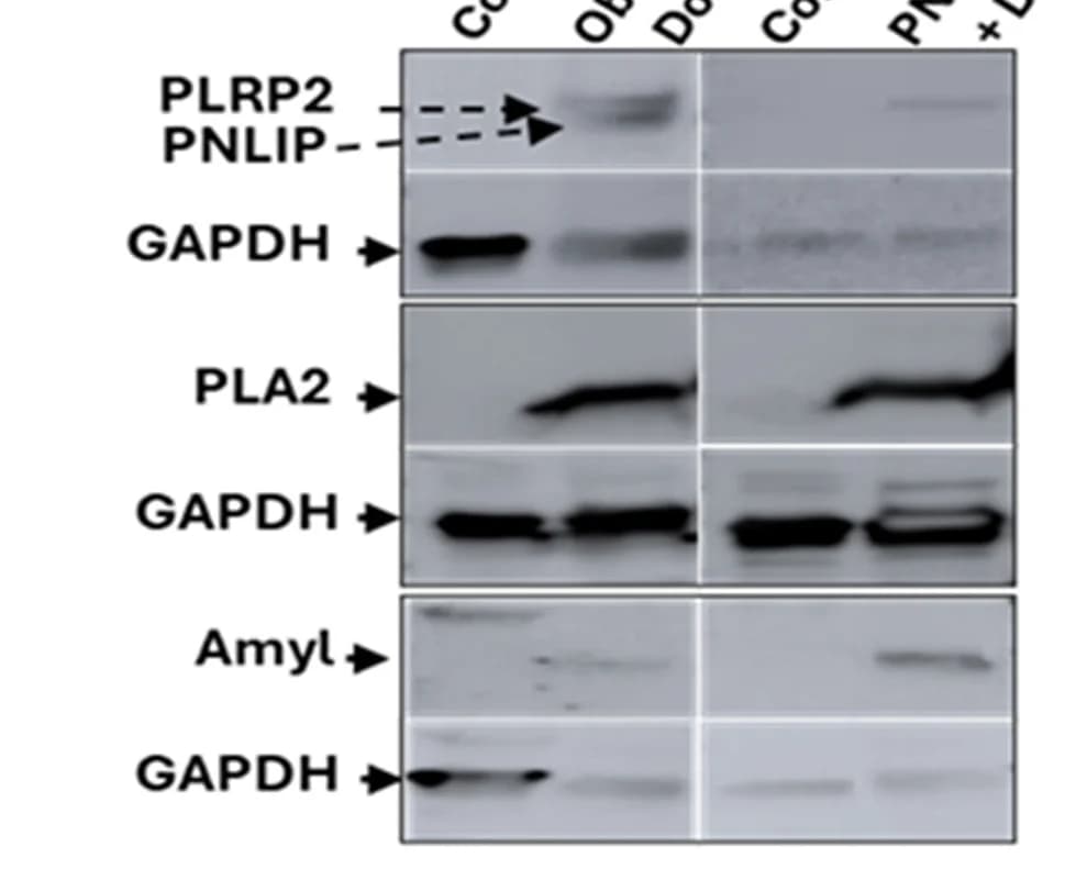 Open access visualization of Gel, Western Blot, PNLIP, PLA2, Amylase