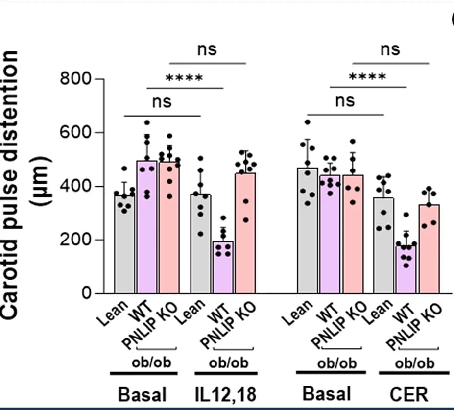 Open access visualization of Bar Plot, Error Bars, Scatter Plot, Carotid Pulse Distention, AP