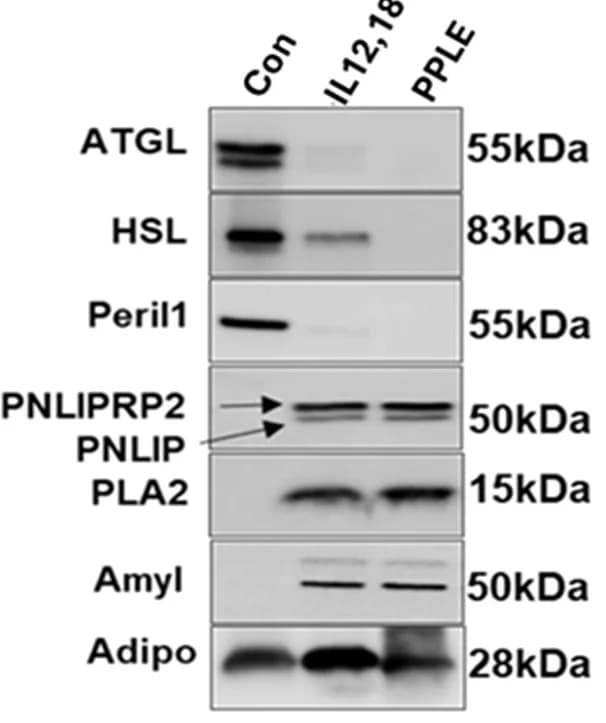 Open access visualization of Gel, Western Blot, ATGL, HSL, Perilipin-1