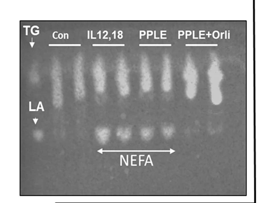 Open access visualization of Gel, Thin-Layer Chromatography, NEFA, Triglycerides, Mice