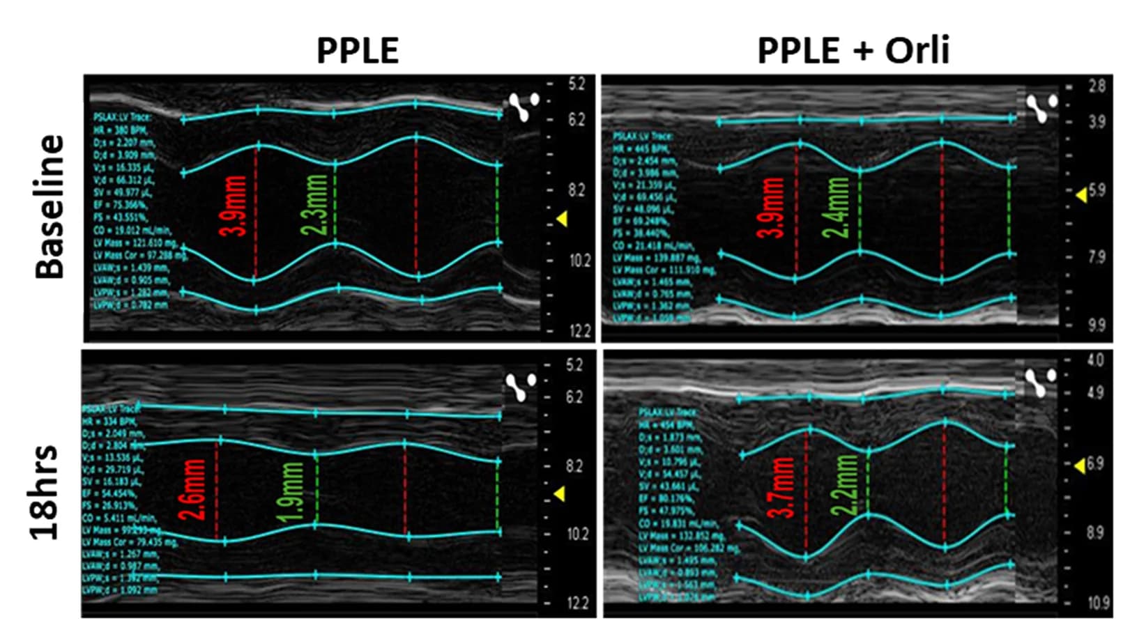 Open access visualization of Microscopy, Echocardiography, Heart, Endocardial Border, Epicardial Border