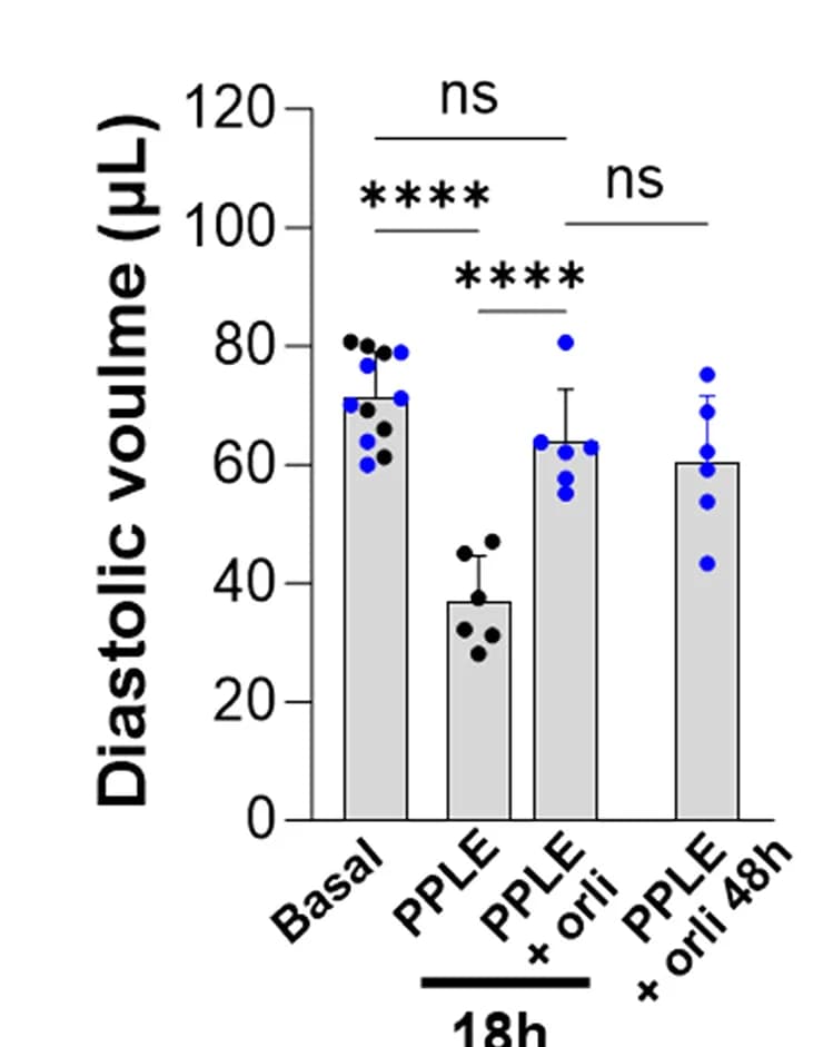 Open access visualization of Bar Plot, Error Bars, Diastolic Volumes, Mice, PPLE