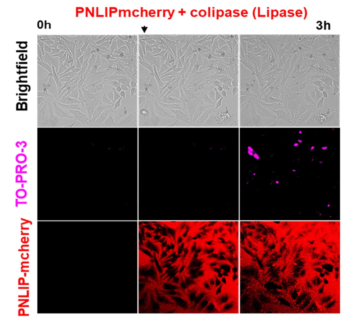 Open access visualization of Microscopy, Live Imaging, HeLa Cells, PNLIPmCherry, CLPS