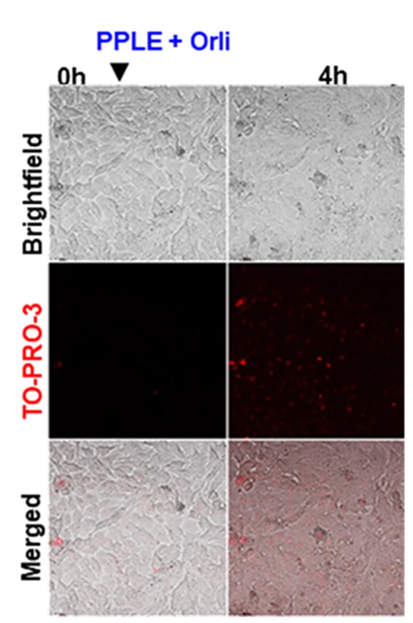 Open access visualization of Microscopy, Live Imaging, PPLE, Orlistat, HeLa Cells