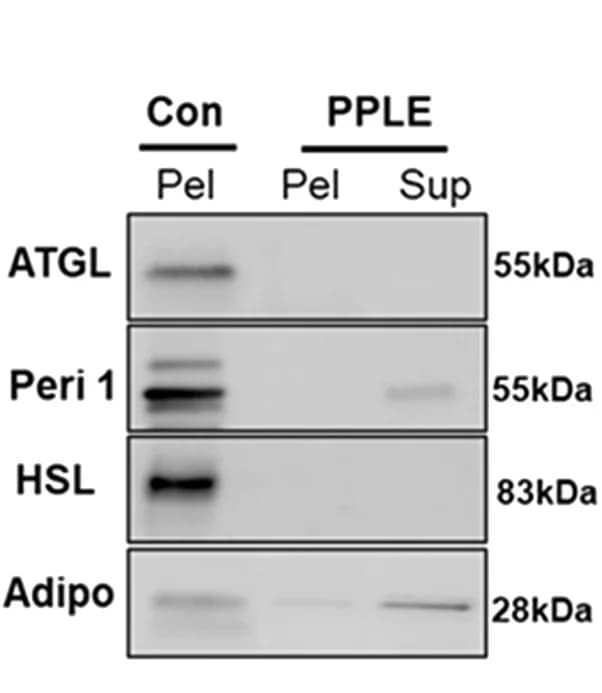 Open access visualization of Gel, Western Blot, ATGL, HSL, Perilipin-1