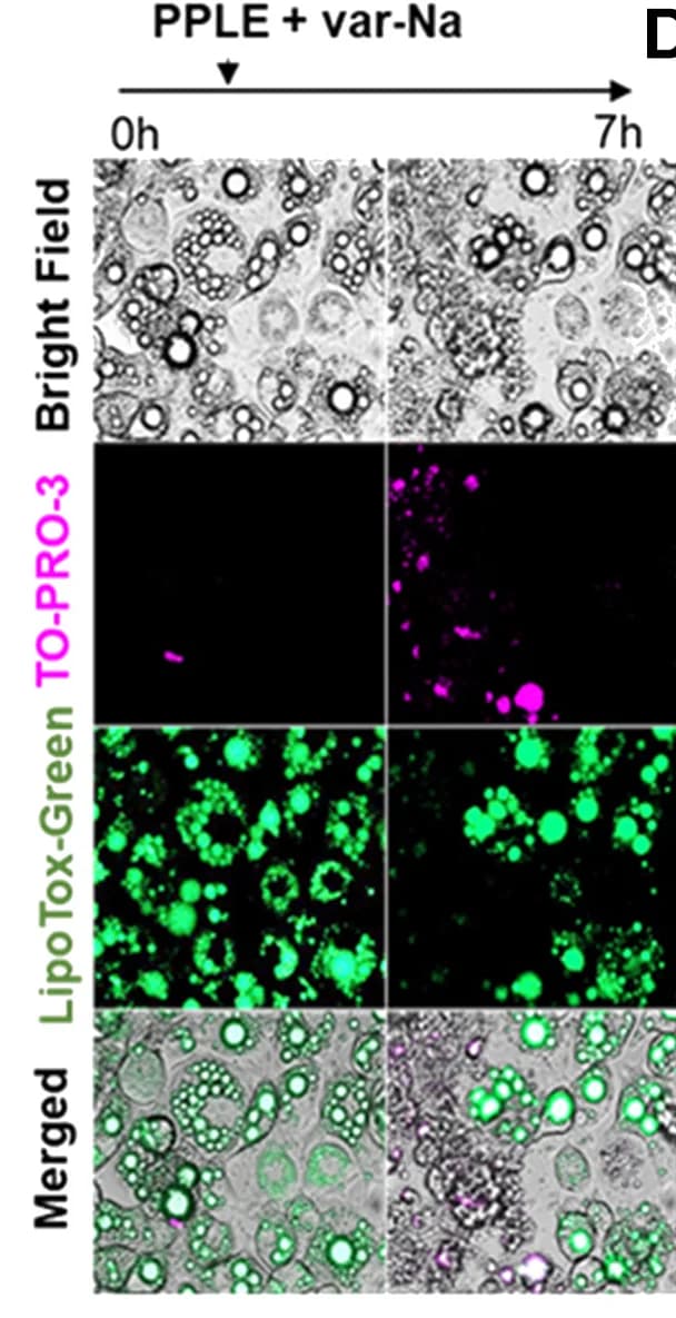 Open access visualization of Microscopy, Var-Na, Orlistat, Lipolysis, 3T3-L1 Cells