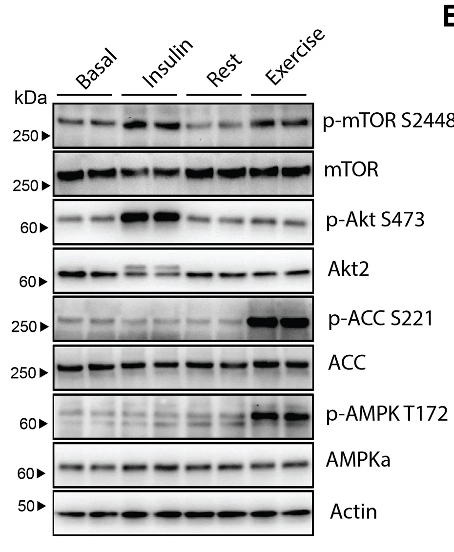 Open access visualization of Gel, Western Blot, Insulin Signaling, Exercise-Induced Signaling