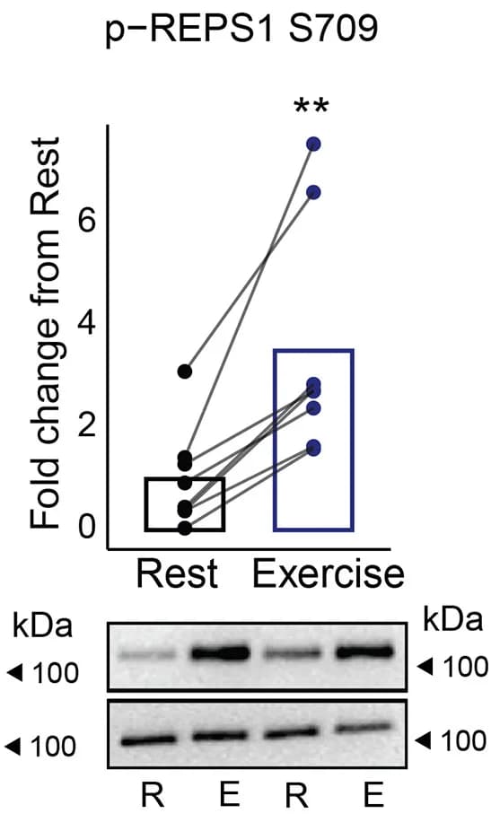 Open access visualization of Line Plot, Photo, Gel, Western Blot, REPS1 Phosphorylation