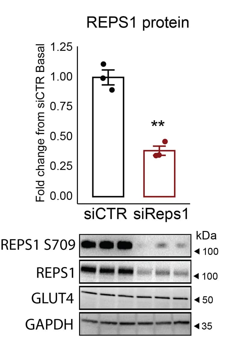 Open access visualization of Bar Plot, Error Bars, Gel, Western Blot, siRNA