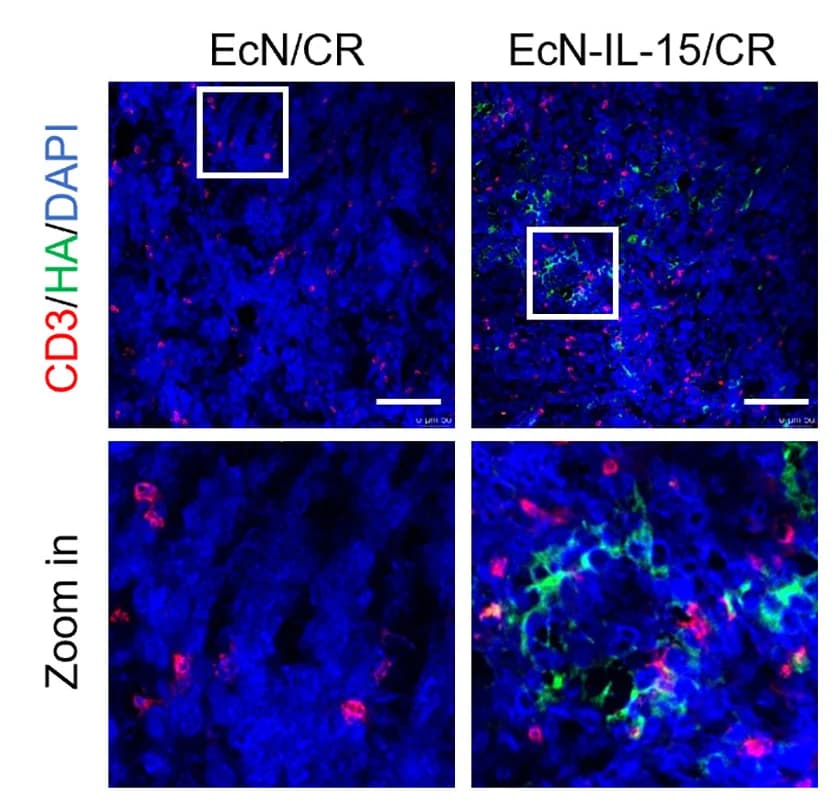 Open access visualization of Microscopy, Immunofluorescence, HA Tag, T Cells, Colon26 Tumor Sections