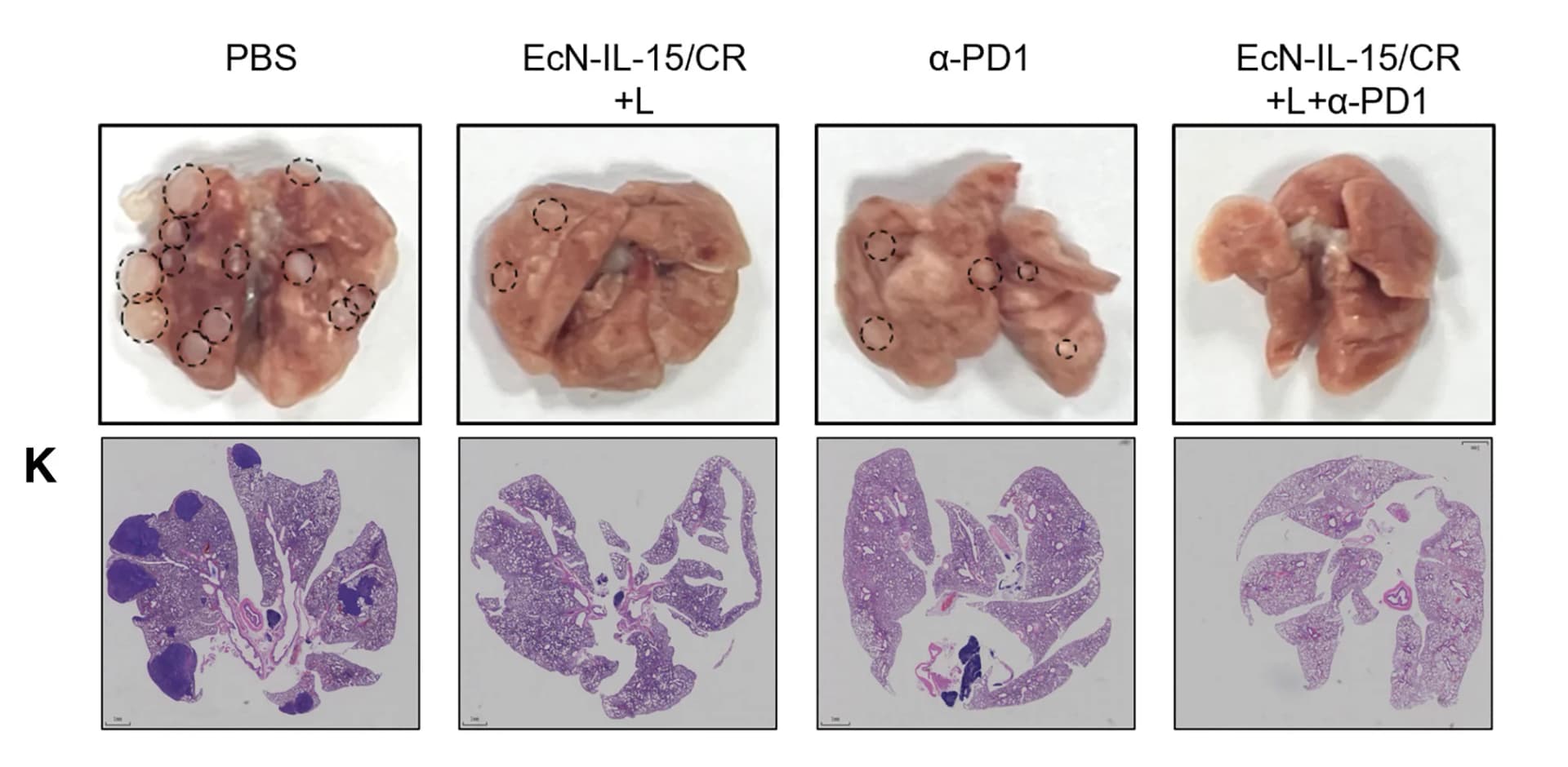Open access visualization of Photo, Microscopy, Lung Metastasis