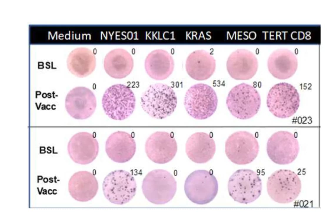 Open access visualization of Microscopy, IFNγ, Epitope Spreading, Patients