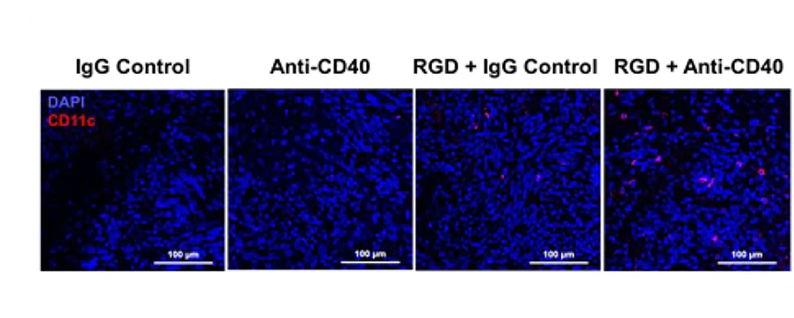 Open access visualization of Microscopy, CD11c-positive Cells, Dendritic Cells, Immunofluorescence Staining, XFM Tumors