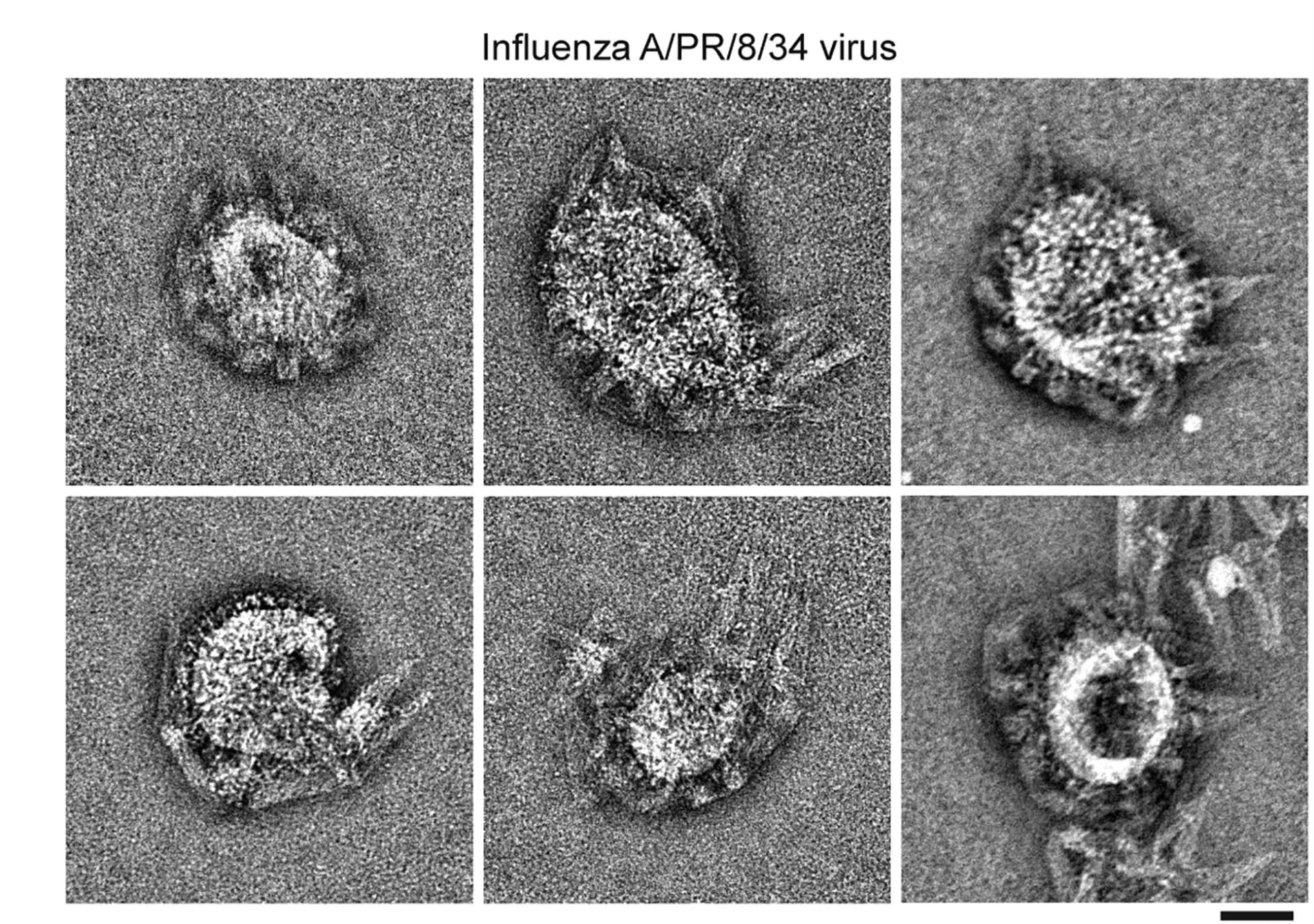 Open access visualization of Microscopy, TEM micrographs, Influenza Virus, Spiked-cone assemblies, Antibodies