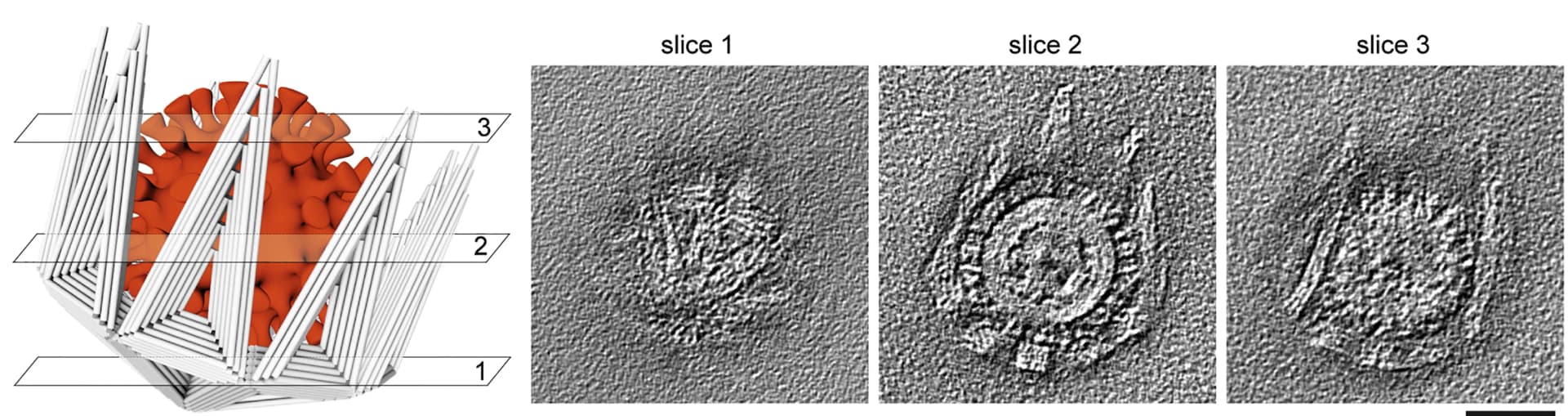 Open access visualization of Microscopy, 3D Plot, Illustration, Negative-stain TEM, Tomogram