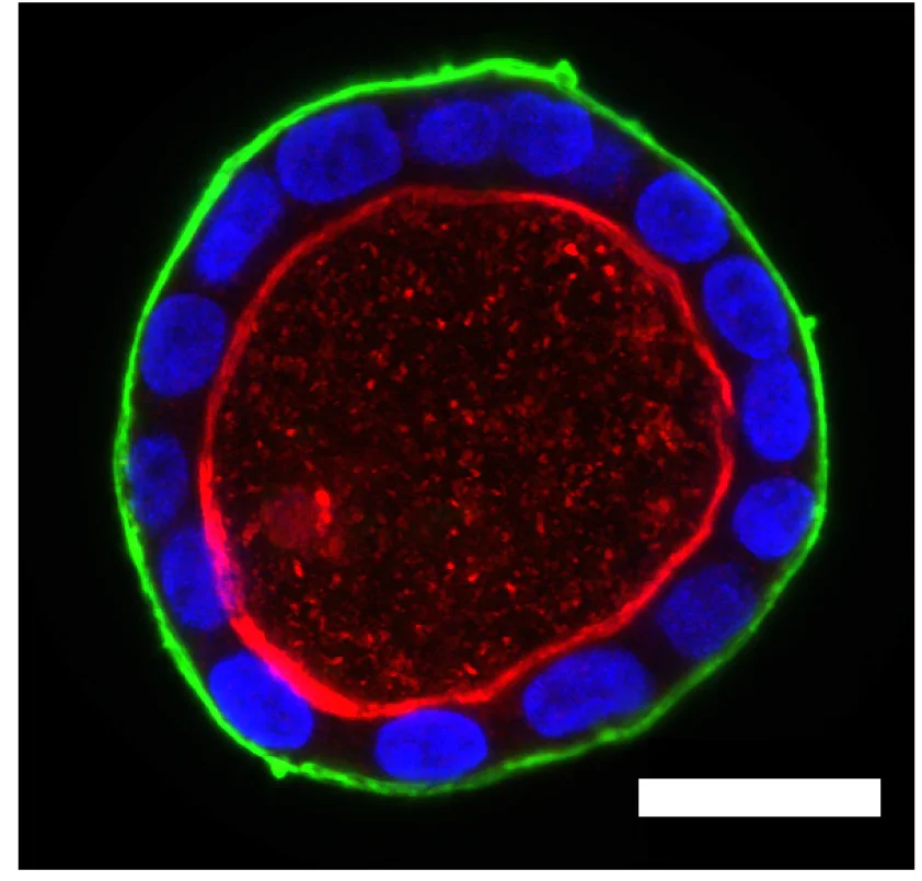 Open access visualization of Microscopy, Confocal Image, MDCK-II Cyst, Nuclei, DAPI