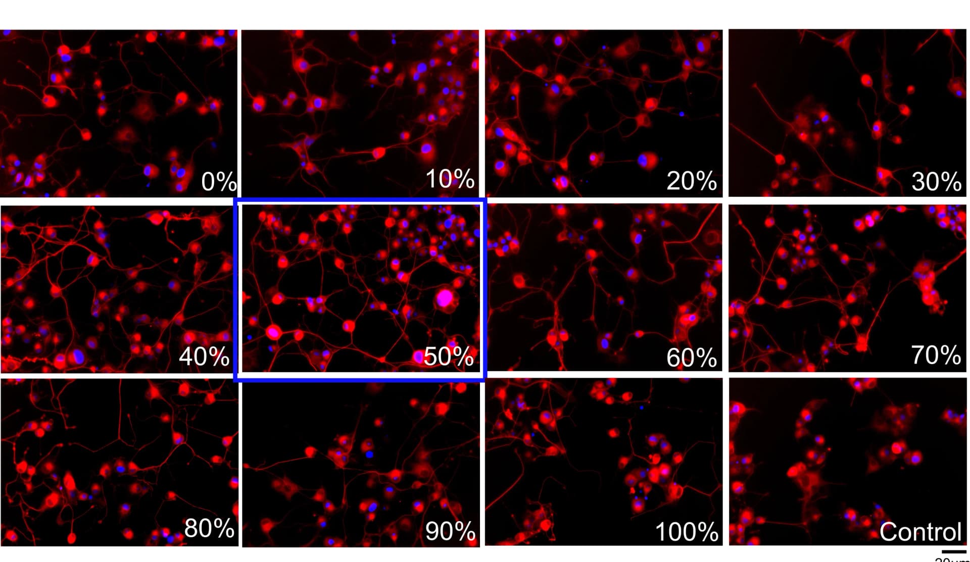 Open access visualization of Microscopy, Fluorescence Images, PC12 Cells, Ultrasonic Duty Cycles, VP
