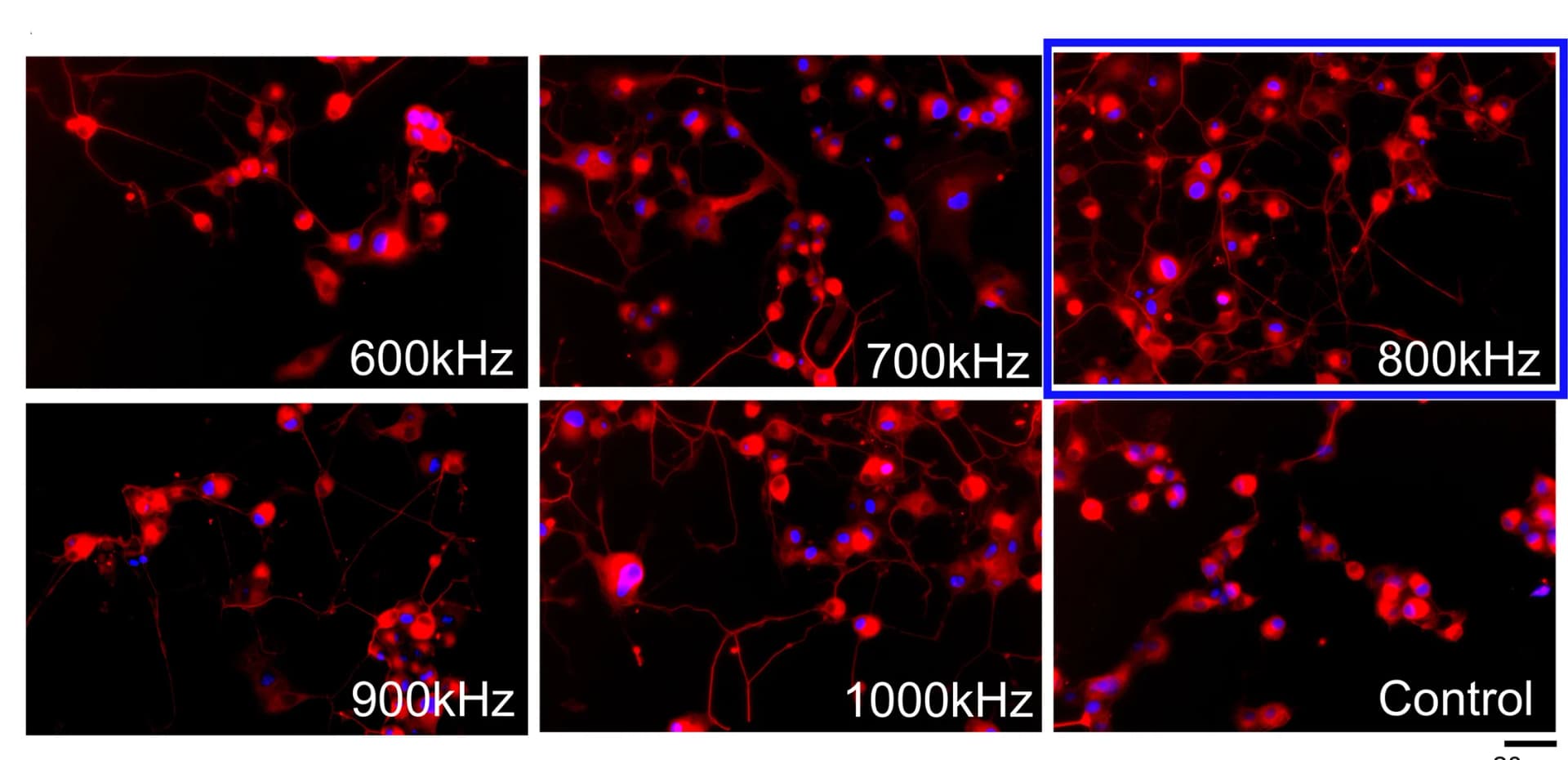 Open access visualization of Microscopy, Fluorescence Images, PC12 Cells, Ultrasonic Frequencies, VP