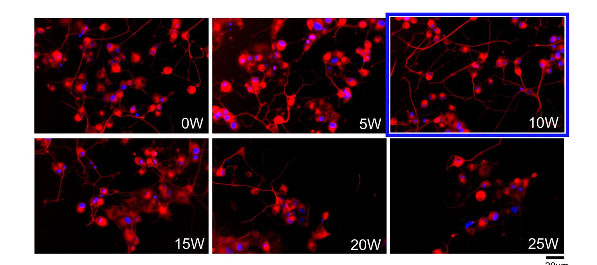 Open access visualization of Microscopy, Fluorescence Images, PC12 Cells, Ultrasonic Vibration, VP