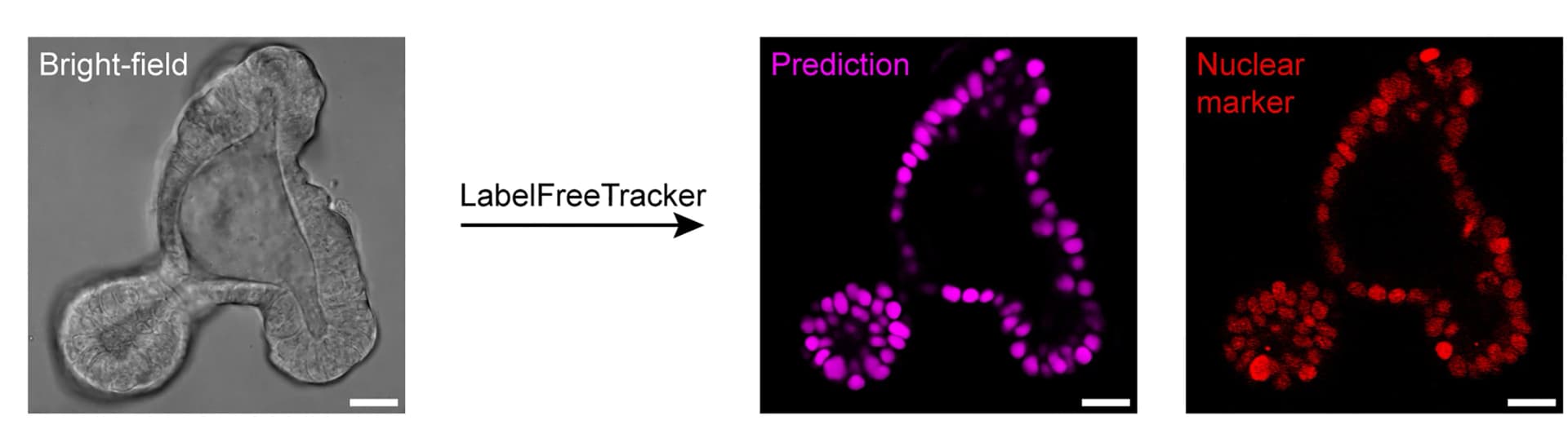 Open access visualization of Microscopy, Bright-Field Image, Mouse Intestinal Organoid, Nuclear Fluorescence, LabelFreeTracker