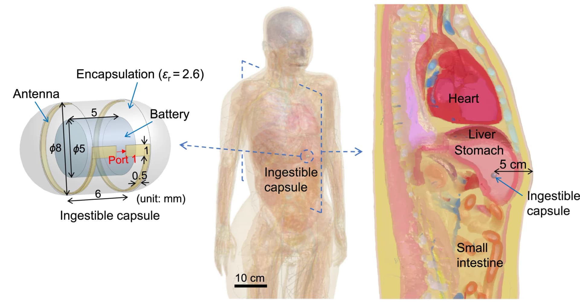 Open access visualization of Illustration, Ingestible Capsule, Stomach, Anatomical Human Model, Numerical Model