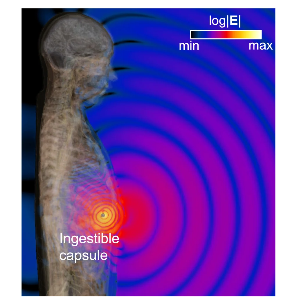 Open access visualization of Photo, Electric-field Distribution, EM Waves, Implant, Biological Tissues