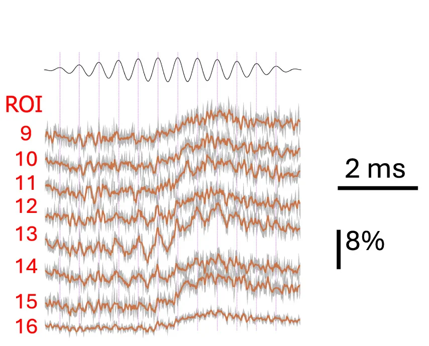 Open access visualization of Line Plot, Membrane Polarization, Sine Wave, Fluorescence, Region of Interest