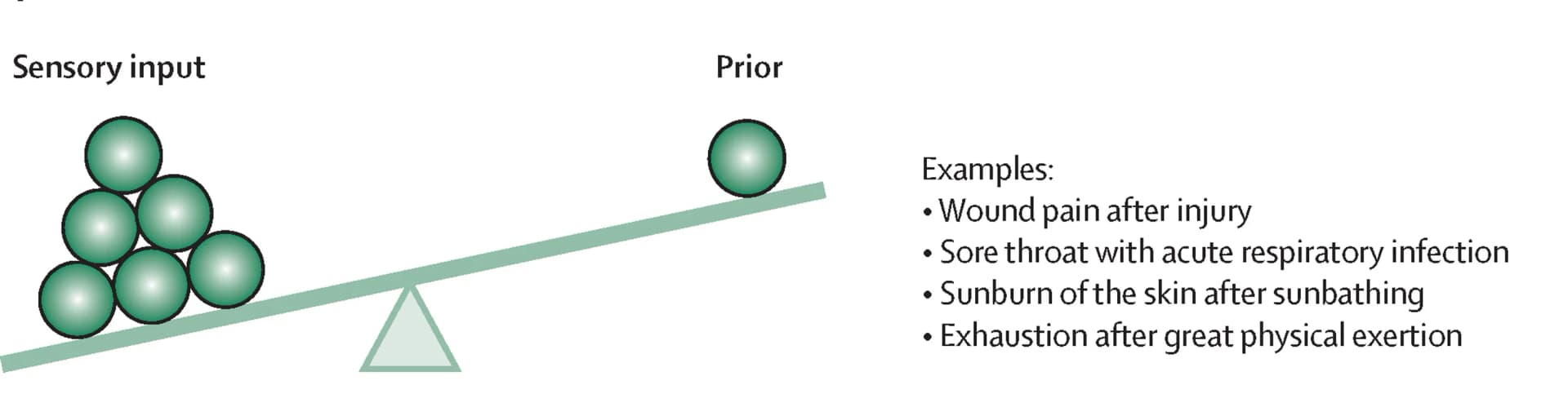 Open access visualization of Illustration, Sensory Input, Posterior Symptom Interpretation, Precision Prior