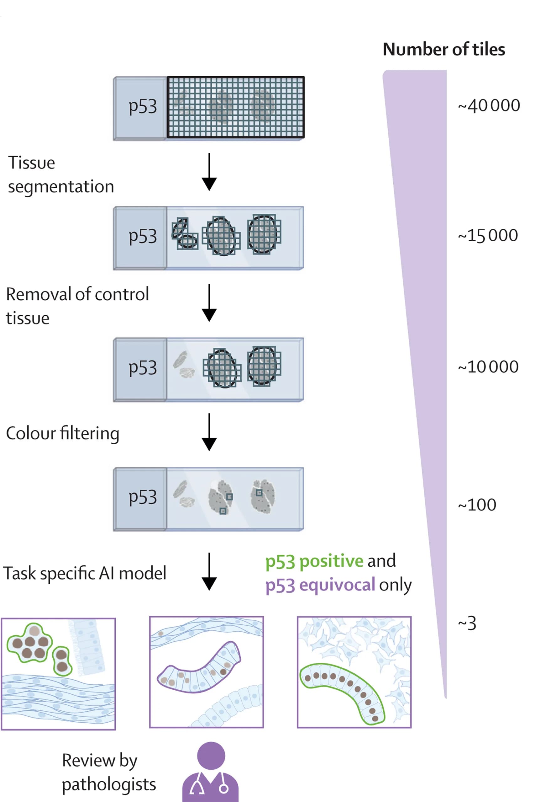 Open access visualization of Workflow, Illustration, Computational Pipeline, Whole-Slide Image Analysis, Pathologist Review