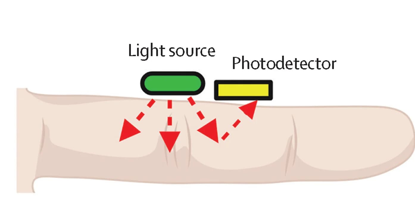 Open access visualization of Illustration, Blood Volume