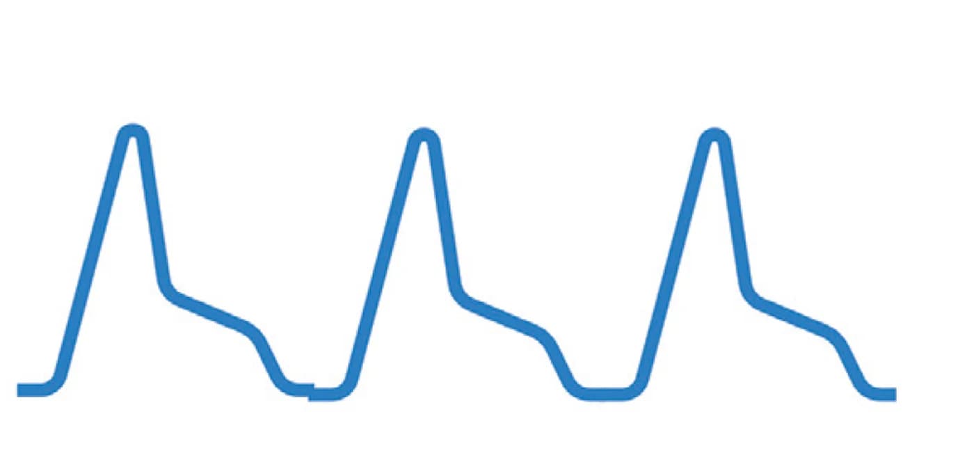 Open access visualization of Line Plot, Cardiovascular Metrics, Signal Intensity