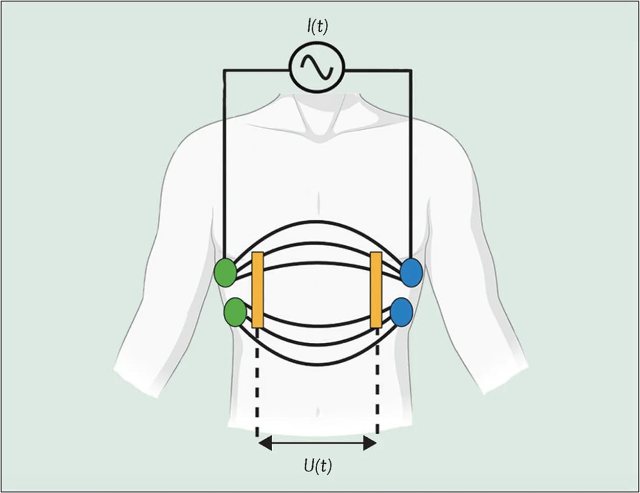 Open access visualization of Illustration, Workflow, Electrodes, Current, Impedance Detection