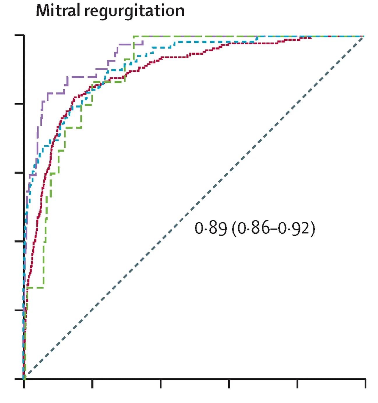 Open access visualization of Line Plot, Line Step, Survival Curve, Receiver Operating Characteristic Curve, Mitral Regurgitation
