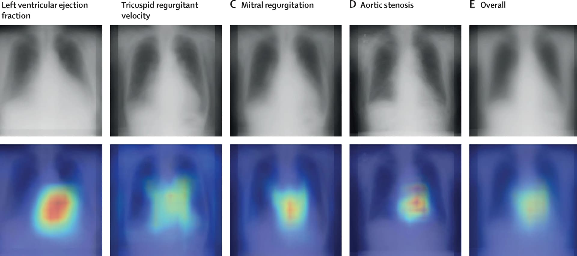Open access visualization of Photo, Microscopy, Chest Radiograph, Saliency Map, Tricuspid Regurgitant Velocity