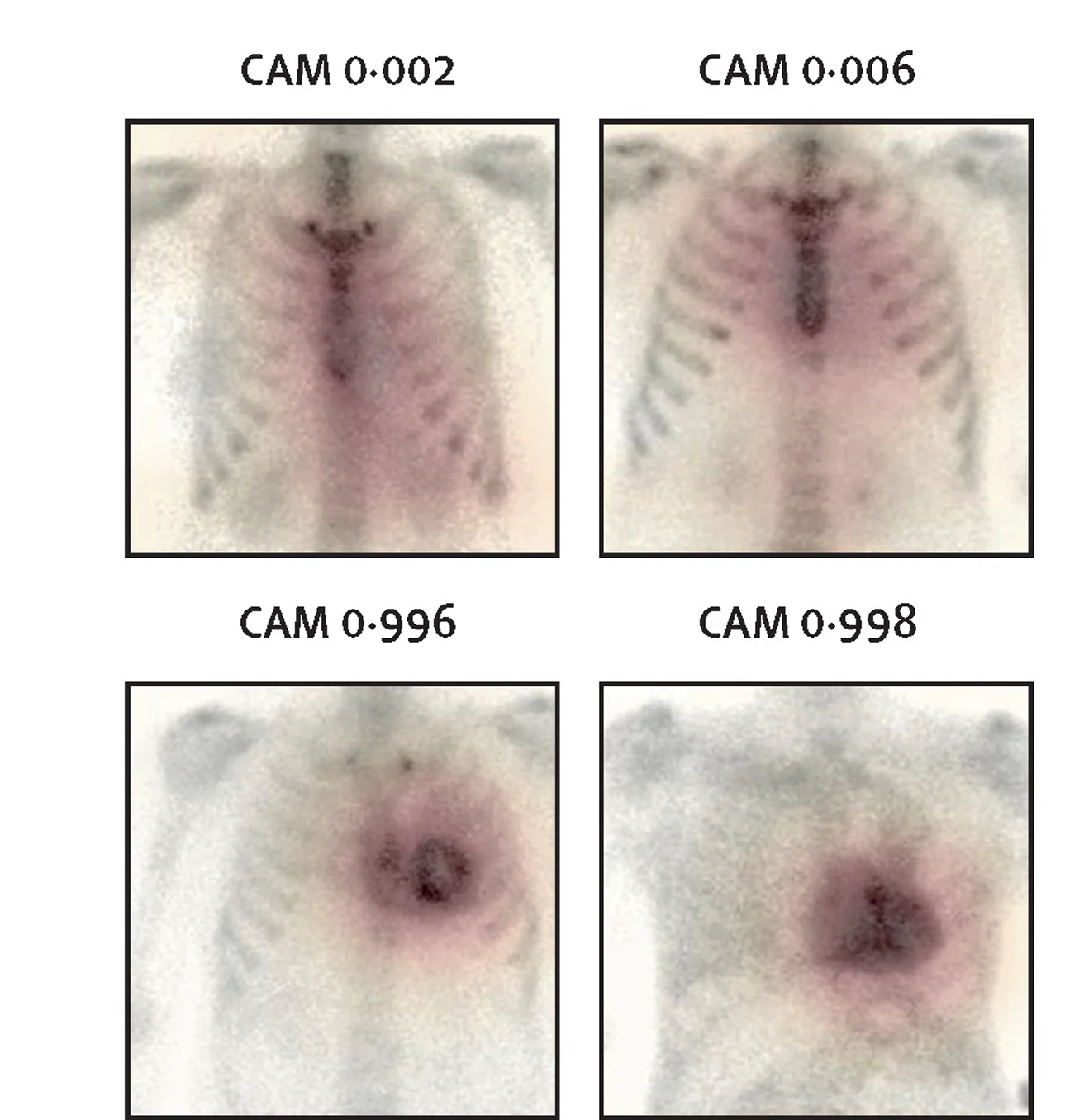 Open access visualization of Microscopy, Photo, Class Activation Maps, Image Regions, Artificial Intelligence