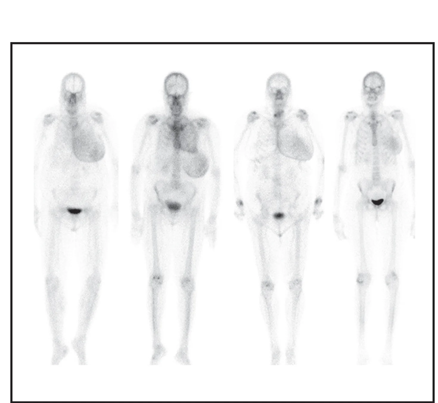 Open access visualization of Photo, Failure Modes, Tracer Uptake, Left Breast, False Positive Predictions