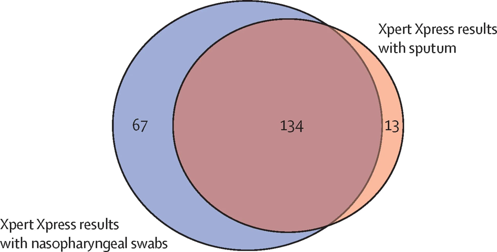 Open access visualization of Venn Diagram, Nasopharyngeal Swab, Sputum, Test Results