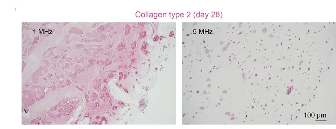 Open access visualization of Microscopy, Collagen Type 2, Immunostaining, US Frequencies