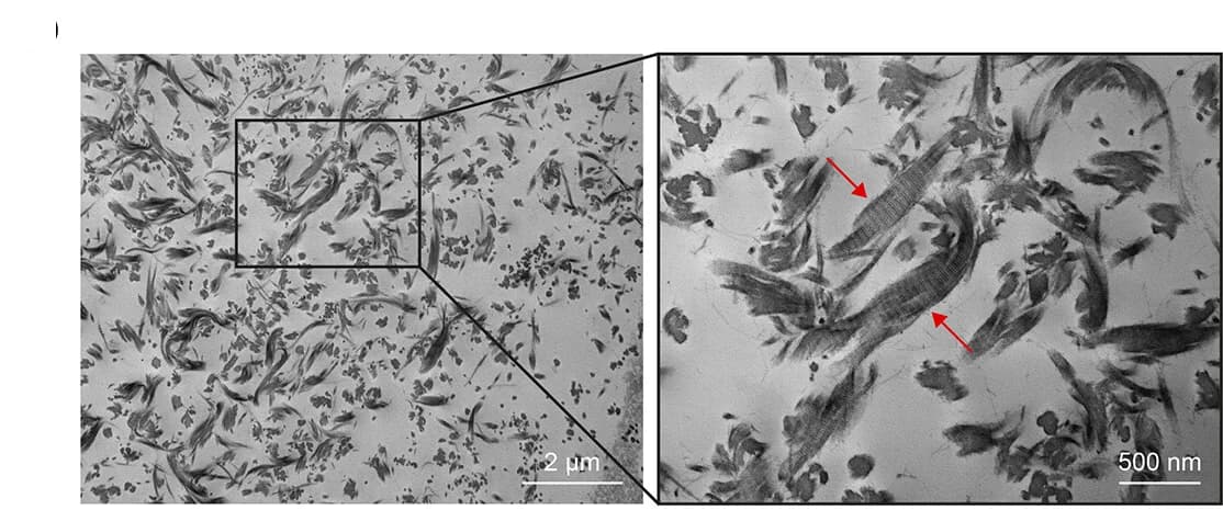 Open access visualization of Microscopy, TEM Image, NanocompUS, Collagen Fibers, Collagen Type 2