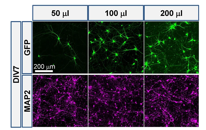 Open access visualization of Microscopy, Quantitative Data, Transfection Efficiency, Neurons, Transfection Conditions