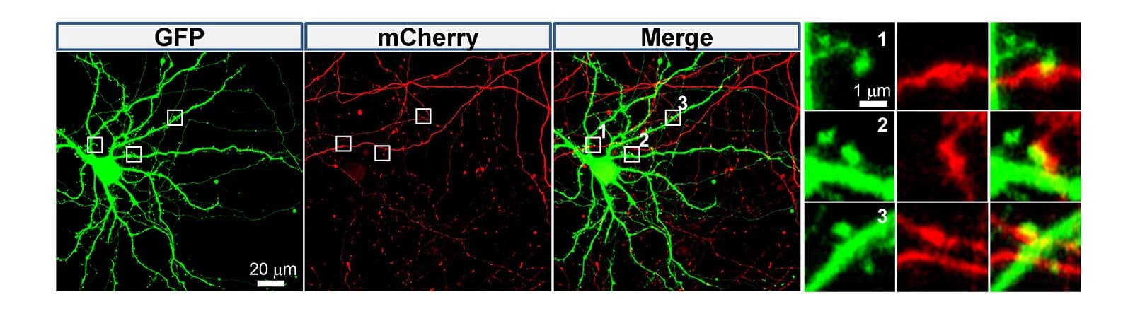 Open access visualization of Microscopy, Representative Images, Serial Transfection, Synaptic Region, Neurons