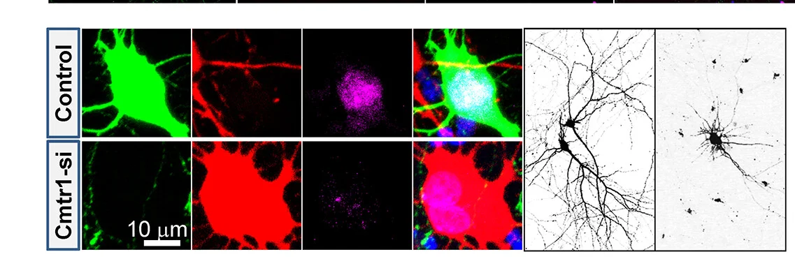 Open access visualization of Microscopy, High-Magnification Images, Transfected Neurons