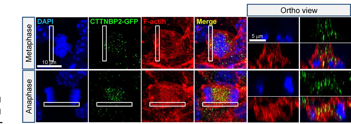 Open access visualization of Microscopy, Representative Images, CTTNBP2-GFP, Neural Stem Cells, Teleofection
