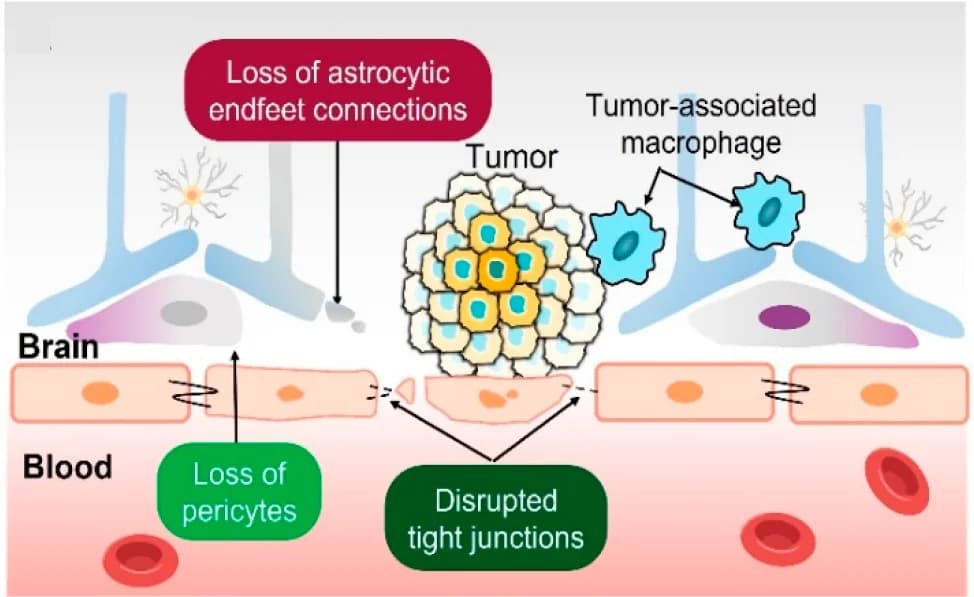 Open access visualization of Illustration, Workflow, Flowchart, Blood-Brain Tumor Barrier, BBTB