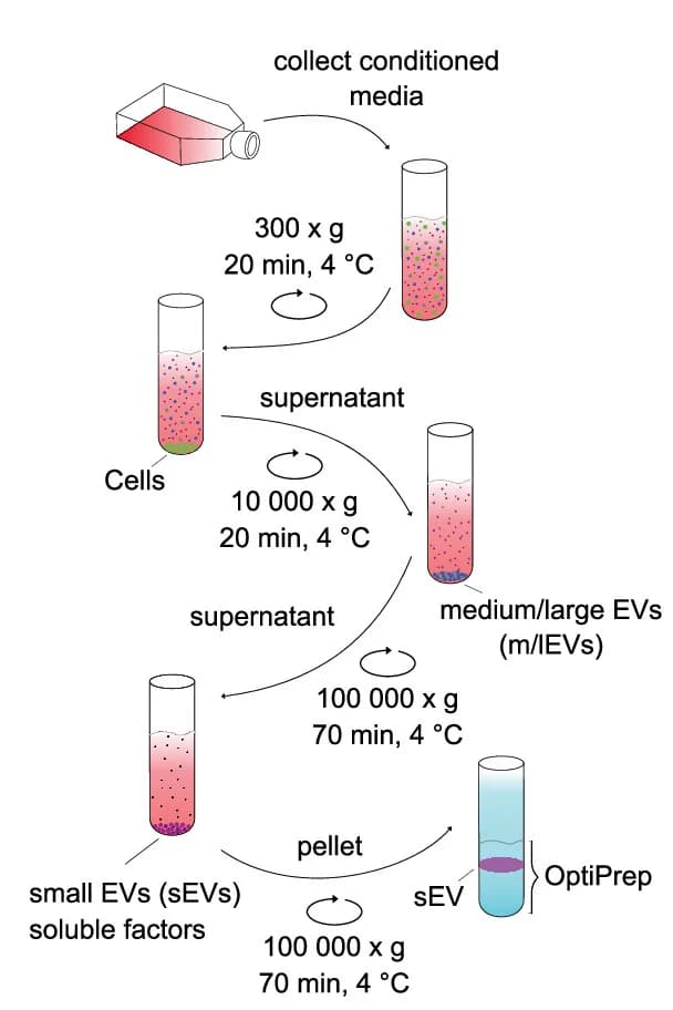 Open access visualization of Workflow, Flowchart, Illustration, sEVs, dUC