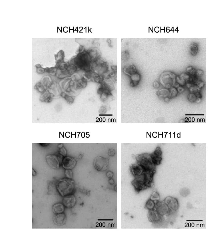 Open access visualization of Microscopy, TEM, sEVs, NCH421k Cells, NCH644 Cells