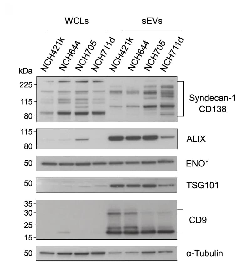 Open access visualization of Gel, Western Blot, Whole-cell Lysates, sEVs, EV Markers